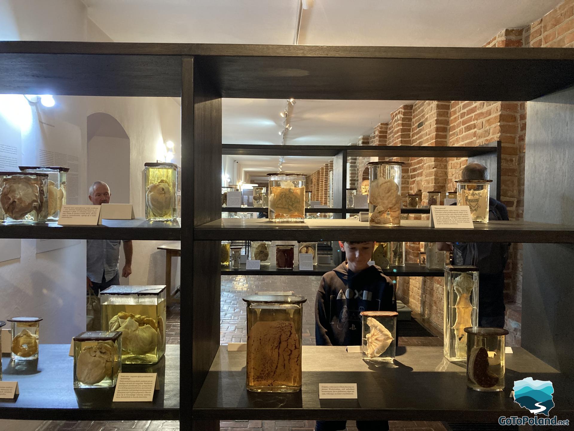 an exhibition with jars in which human organs were placed